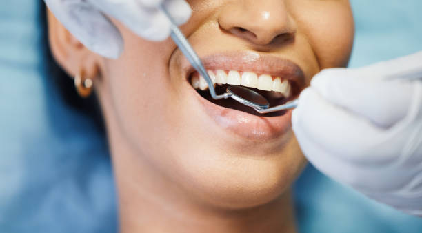Best Dentist for Dental Trauma  in Spring Park, MN